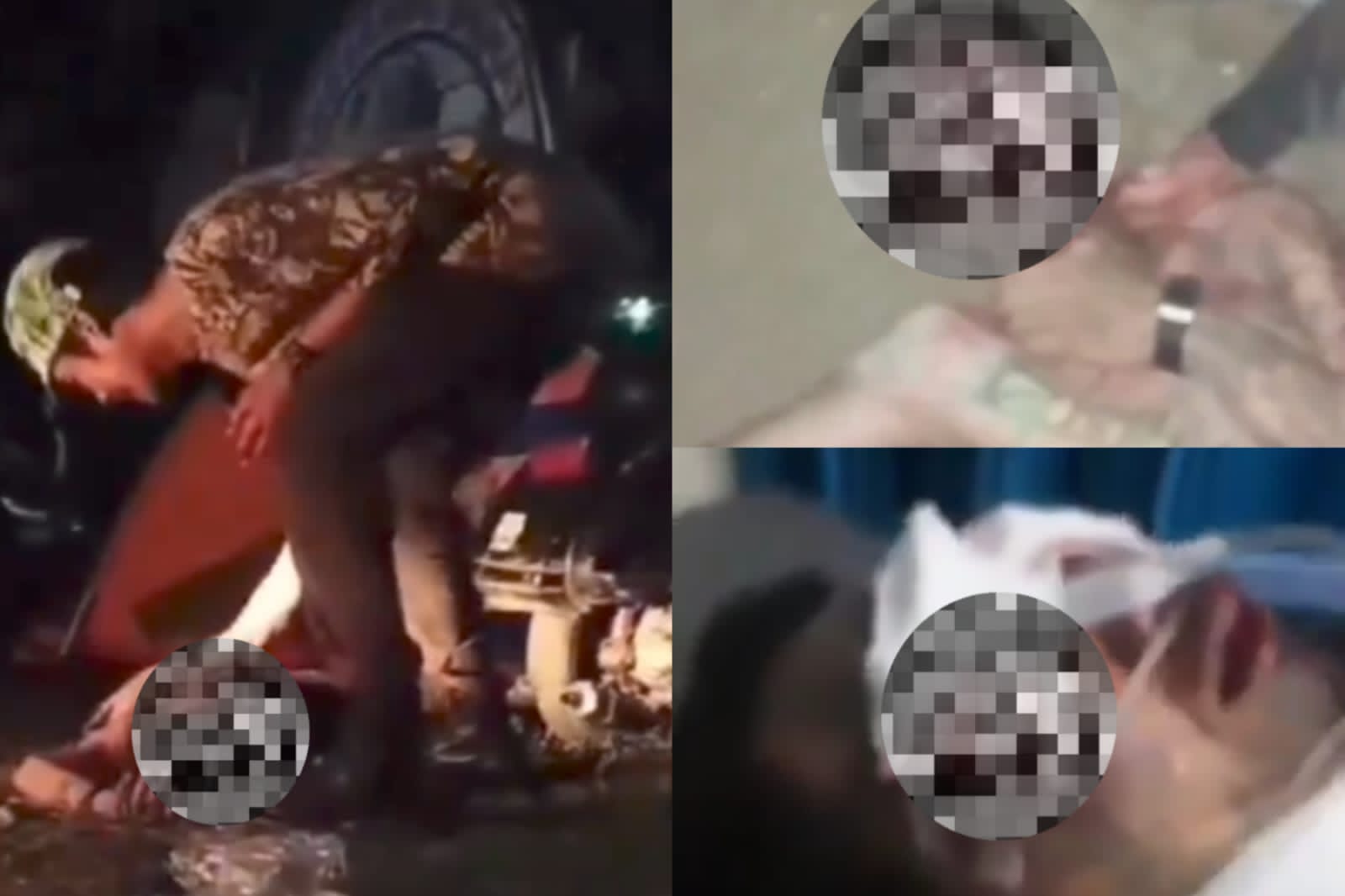 Polisi Selidiki Kasus Penganiayaan Pencungkilan Bola Mata