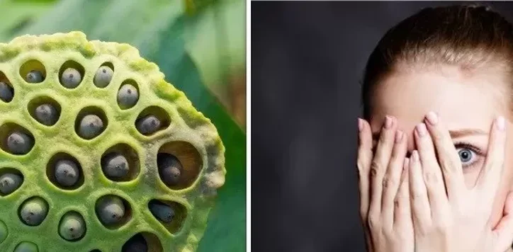 5 Fobia Unik yang Jarang Disadari, Mungkin Anda Mengalaminya?