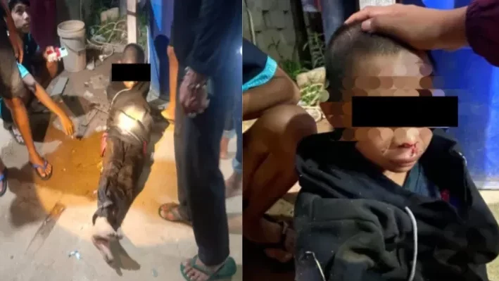 Kondisi korban DI, anak 13 tahun, yang mengalami luka lebam usai diduga dianiaya oleh pemilik warung di Desa Muara Jekak, Ketapang. (Dok. Ist)