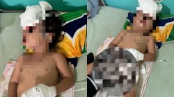 Balita Qanisha (2), yang kini dirawat intensif usai tabrakan di Desa Riam Bunut, Ketapang, pada Rabu, 2 Juli 2025, sekitar pukul 15.00 WIB.