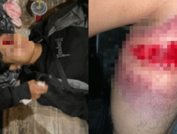 Demo Solo Ricuh: Seorang Reporter dan Pengemudi Ojol Diduga Terluka Akibat Peluru Karet