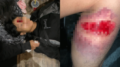 Demo Solo Ricuh: Seorang Reporter dan Pengemudi Ojol Diduga Terluka Akibat Peluru Karet