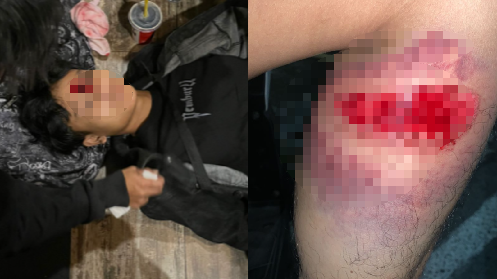 Kolase foto kondisi korban dalam aksi demo di Solo, Jumat (29/8/2025). Sisi kiri menunjukkan seorang yang terluka di bagian kepala, sementara sisi kanan memperlihatkan luka di kaki seorang yang diduga akibat peluru karet.