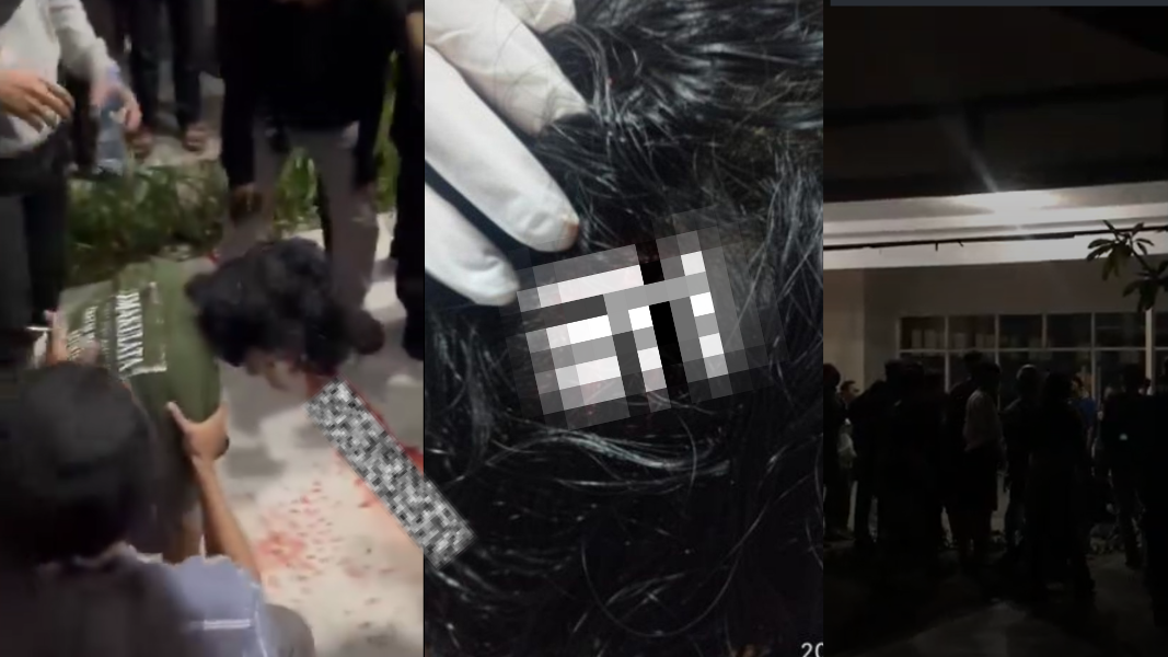 Seorang mahasiswa Untan bernama Arif mendapat perawatan setelah mengalami luka di kepala akibat diduga terkena peluru karet saat aksi demonstrasi di DPRD Kalbar. (Dok. Faktakalbar.id)