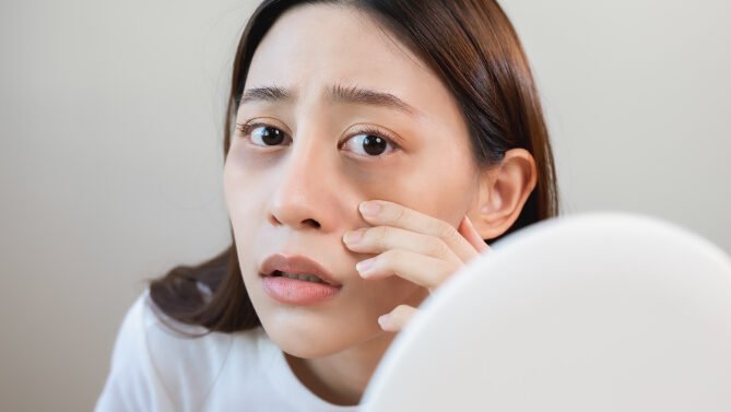 "Ketahui penyebab dan cara efektif menghilangkan kantung mata. Ikuti panduan praktis ini untuk mendapatkan kembali tampilan wajah yang segar dan cerah. "