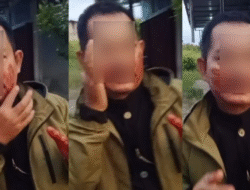 Pengendara Motor di Mempawah Terluka Parah Akibat Jeratan Benang Layangan