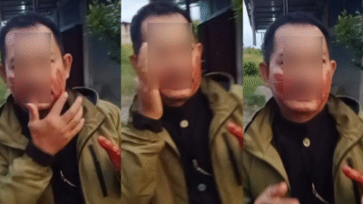 Mukmin, seorang warga Desa Peniti Dalam 1, menunjukkan luka parah di jempolnya akibat terkena benang layangan saat melintas di Jalan Jongkat–Segedong, Mempawah.