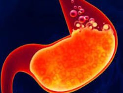 Pertolongan Pertama Saat Asam Lambung Naik dan Jauh dari Obat