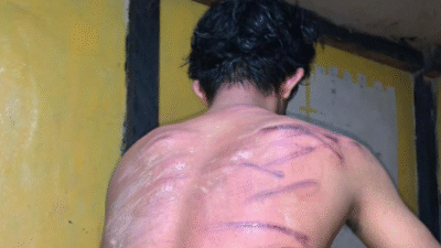 Kondisi seorang karyawan PT. Rimba di Air Upas, Ketapang, yang diduga menjadi korban penganiayaan oleh oknum TNI yang bertugas sebagai pengamanan perusahaan. (Dok. Ist)