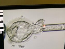 Lahir dari Embrio Beku 31 Tahun, Bayi di AS Pecahkan Rekor Dunia