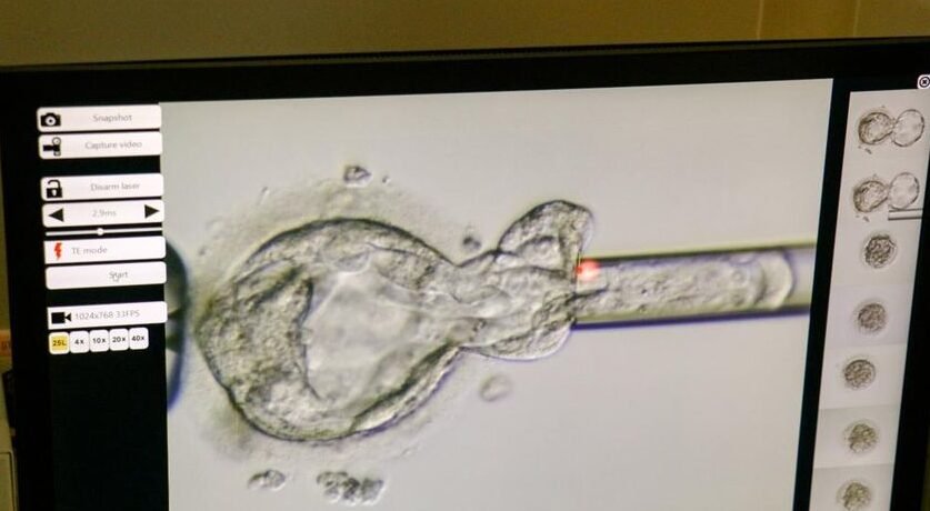 "Bayi Thaddeus Daniel Pierce lahir di AS dari embrio yang dibekukan selama 31 tahun (sejak 1994), memecahkan rekor dunia baru untuk adopsi embrio."