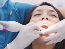 Scaling Gigi Gratis Pakai BPJS Kesehatan, Ini Syarat dan Prosedurnya