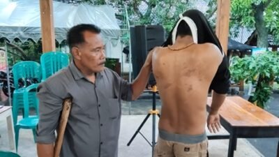 Muhammad Rifai alias Radit (31), warga Tuban yang diduga menjadi korban salah tangkap, menunjukkan bekas luka penganiayaan di tubuhnya kepada awak media, Kamis (27/11/2025).