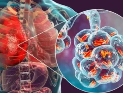 Jangan Tunggu Sesak Napas, Ini 6 Langkah Emas Lindungi Paru-Paru dari Pneumonia