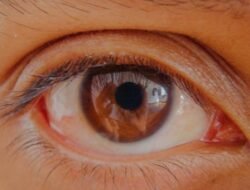 Tak Hanya Tetes Mata! 3 Cara Mengatasi Mata Kering di Rumah Menurut Dokter Spesialis