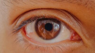 3 Cara Mengatasi Mata Kering di Rumah Menurut Dokter