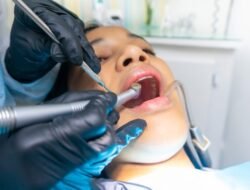 Cuma Gingivitis Akut yang Dijamin! Ini Syarat dan Alur Scaling Gigi Gratis Pakai BPJS