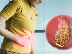 Sering Nyeri Ulu Hati? Jangan Disepelekan, Bisa Jadi Tanda Batu Empedu Mengintai