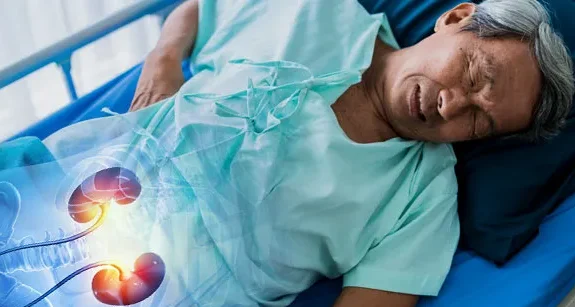 "Waspada, 5 kebiasaan sepele ini bisa jadi penyebab batu ginjal. Mulai dari kurang minum, terlalu banyak makan asin, hingga 'mager' bisa memicu endapan kristal."