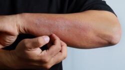 Bukan Cuma Dingin! Ini 8 Penyebab Kulit Kering Disertai Gatal