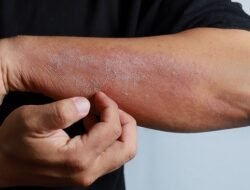 Waspada! Kulit Kering dan Gatal Bisa Jadi Gejala 8 Penyakit Serius, dari Ginjal hingga Kanker Darah