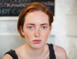 Mitos Minum Air Putih Menghilangkan Jerawat: Dokter Jelaskan Peran Sejati Air untuk Skin Barrier