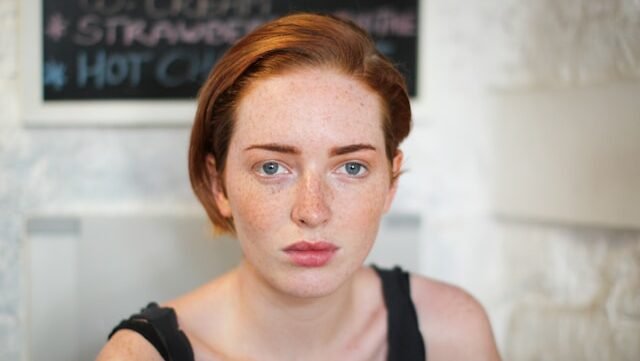 Minum Air Putih Menghilangkan Jerawat Hanya Mitos