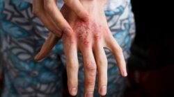 "Waspada air kotor pembawa wabah. Kenali 4 penyakit langganan saat musim banjir, mulai dari Leptospirosis hingga DBD, serta cara efektif mencegahnya."