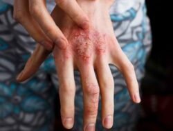 Waspada Musim Hujan: Kenali 4 Penyakit “Langganan” Saat Banjir dan Cara Mencegahnya