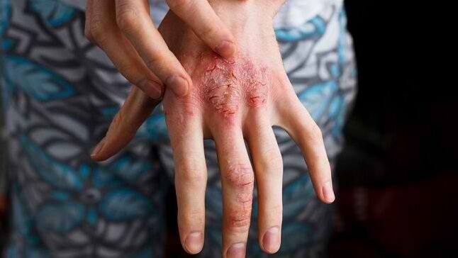 "Waspada air kotor pembawa wabah. Kenali 4 penyakit langganan saat musim banjir, mulai dari Leptospirosis hingga DBD, serta cara efektif mencegahnya."