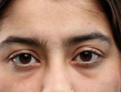 6 Cara Menyamarkan Mata Panda agar Wajah Terlihat Segar Seketika