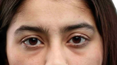 "Wajah terlihat lelah karena lingkaran hitam? Simak 6 cara menyamarkan mata panda dengan teknik makeup dan perawatan sederhana yang ampuh bikin wajah segar seketika."