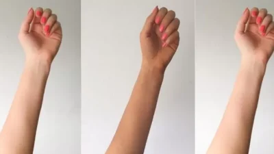 "Punya masalah kulit belang akibat sering naik motor atau kena matahari? Jangan khawatir. Simak tips meratakan warna kulit yang aman dan efektif di sini."