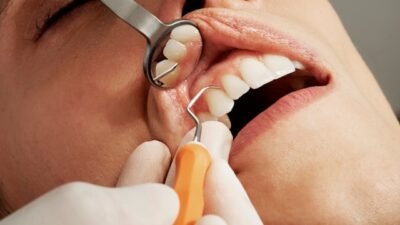 5 Cara Mencegah Plak Gigi: Ubah Teknik Sikat Gigi dan Flossing