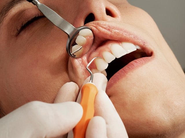 5 Cara Mencegah Plak Gigi: Ubah Teknik Sikat Gigi dan Flossing