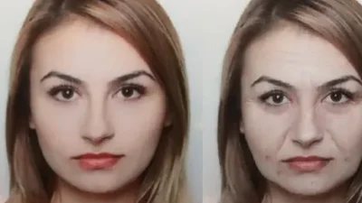 "Stres bukan hanya masalah pikiran, tapi bisa merusak penampilan. Kenali 5 tanda fisik pada wajah yang menunjukkan kadar kortisol Anda sudah terlalu tinggi."