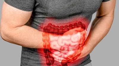 "Kenali 7 tanda kemungkinan usus bocor atau peningkatan permeabilitas intestinal. Pahami penyebab ilmiah dari sisi gaya hidup dan dampaknya bagi kesehatan. "