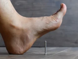 4 Langkah Pertolongan Pertama Saat Terinjak Paku: Jangan Panik, Lakukan Ini!