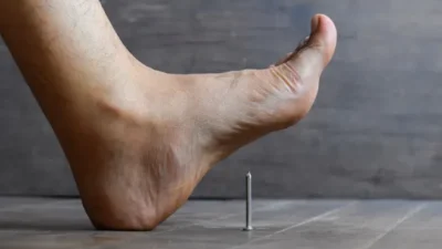 "Kaki tertusuk paku berkarat? Jangan panik. Simak 4 langkah pertolongan pertama ini untuk menghentikan pendarahan, mencegah infeksi, dan menghindari risiko tetanus."