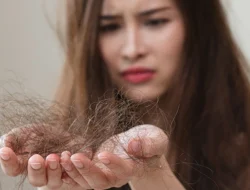 Fenomena Kebotakan Dini: Mengapa Rambut Gen Z Lebih Rapuh Dibanding Millenial?