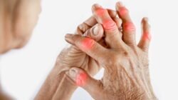 "Mengalami nyeri sendi mendadak? Ketahui hal yang wajib dilakukan saat asam urat kambuh untuk meredakan nyeri dan bengkak dengan cepat secara alami."