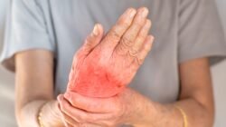 "Simak kebiasaan siang hari yang efektif menekan kadar asam urat secara alami. Panduan memilih menu makan siang dan hidrasi tepat bagi perempuan dan laki-laki."