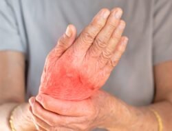 Tips Anti Gout: Kebiasaan Siang Hari untuk Menekan Asam Urat Secara Alami