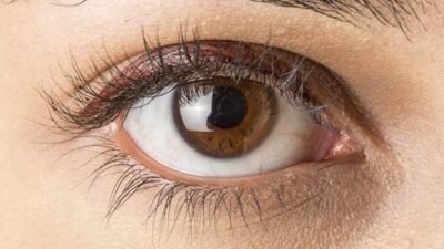 "Waspadai tanda penyakit ginjal melalui mata. Mulai dari penglihatan kabur hingga munculnya bintik hitam, kenali 5 gejala kerusakan ginjal sejak dini."