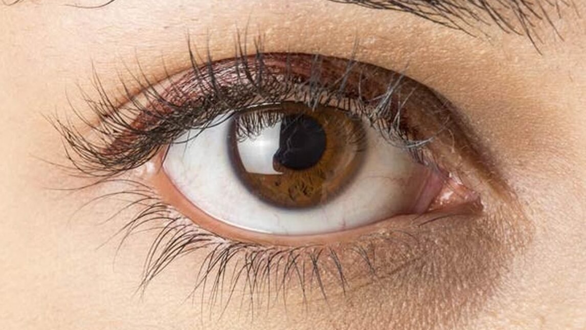 "Waspadai tanda penyakit ginjal melalui mata. Mulai dari penglihatan kabur hingga munculnya bintik hitam, kenali 5 gejala kerusakan ginjal sejak dini."