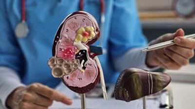 Ilustrasi pemeriksaan medis organ dalam yang sangat penting dilakukan untuk mendeteksi penyakit kanker ginjal sejak stadium awal.