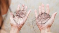 "Mengapa stres bikin rambut rontok parah? Pahami fenomena telogen effluvium dan pengaruh hormon kortisol terhadap kesehatan akar rambut Anda."