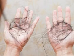 Sering Tidak Disadari, Ini Alasan Medis Kenapa Saat Stres Rambut Kamu Mudah Rontok