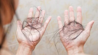 "Mengapa stres bikin rambut rontok parah? Pahami fenomena telogen effluvium dan pengaruh hormon kortisol terhadap kesehatan akar rambut Anda."