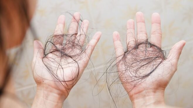 "Mengapa stres bikin rambut rontok parah? Pahami fenomena telogen effluvium dan pengaruh hormon kortisol terhadap kesehatan akar rambut Anda."